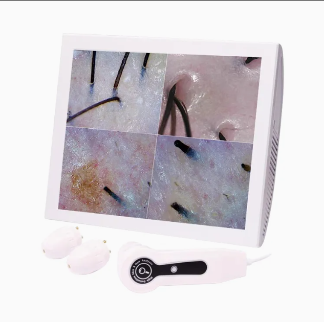 Scalp Vision AI Android Cilt & Saç Analiz Sistemi
